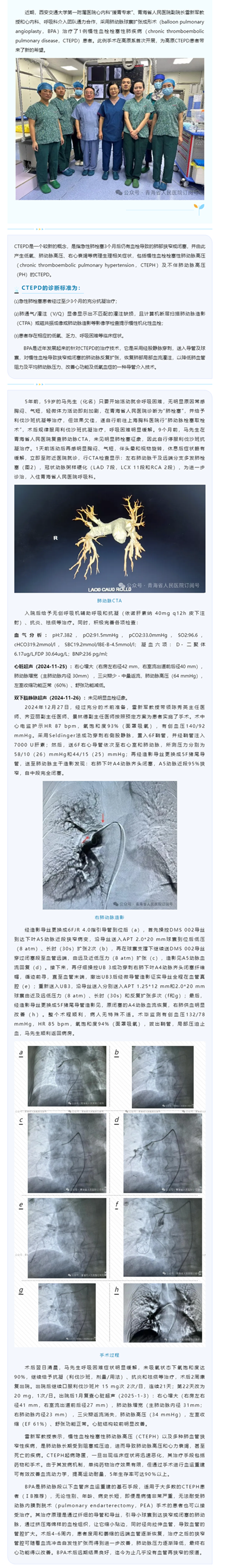【精术】高原首例！青海省人民医院采用肺动脉球囊扩张成形术治疗1例慢性血栓栓塞性肺疾病